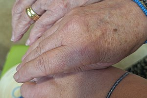 Drei Hände unterschiedlicher Hautfarbe übereinandergelegt, zwei davon mit blauen Armbändern und eine mit goldenen Ringen